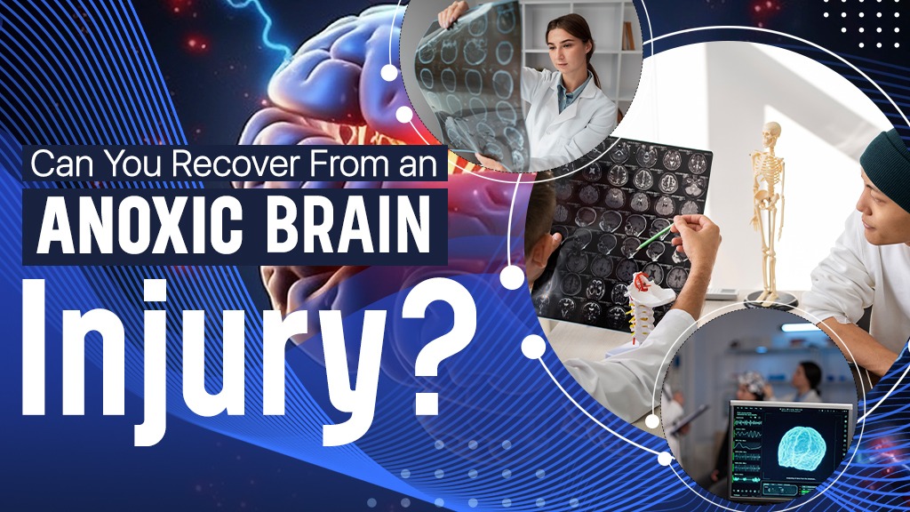 Anaheim brain injury lawyer