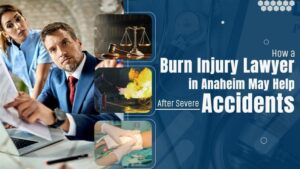 burn injury lawyer in Anaheim